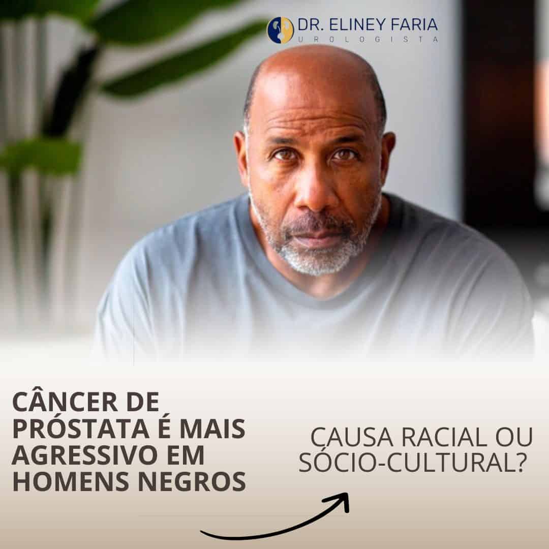 O câncer próstata pode ser mais agressivo em homens negros