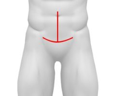 incisao-normal-prostata